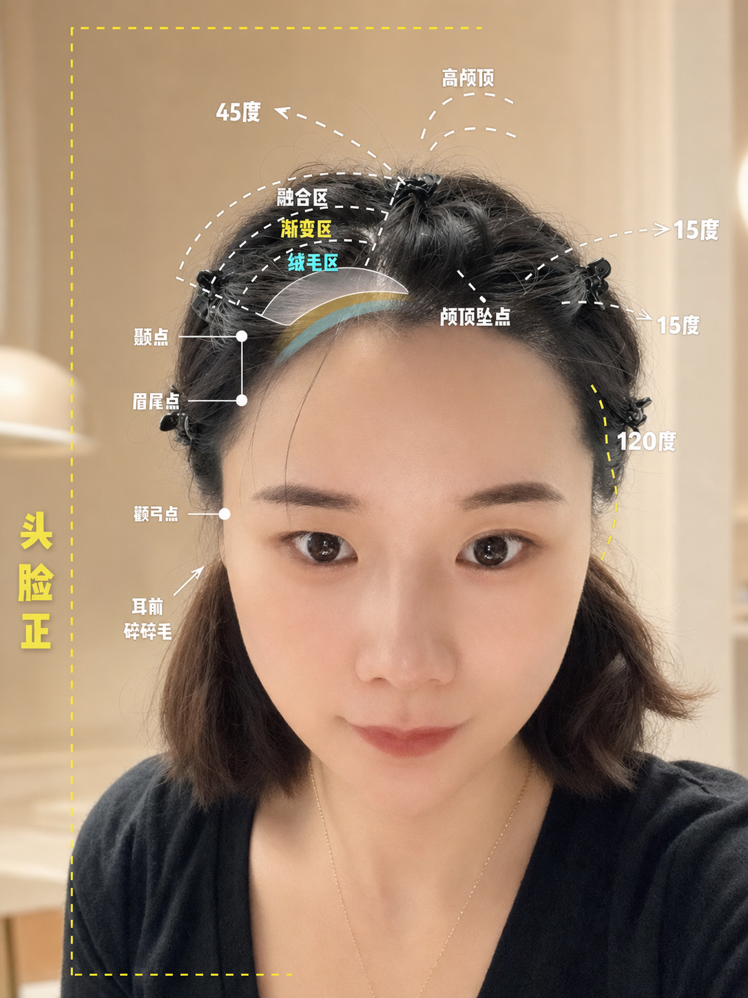 35岁服装店老板娘:发量增加成功案例